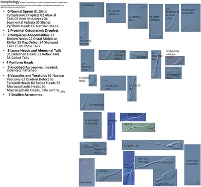 The Role of Sperm Morphology Standards in the Laboratory Assessment of Bull Fertility in Australia